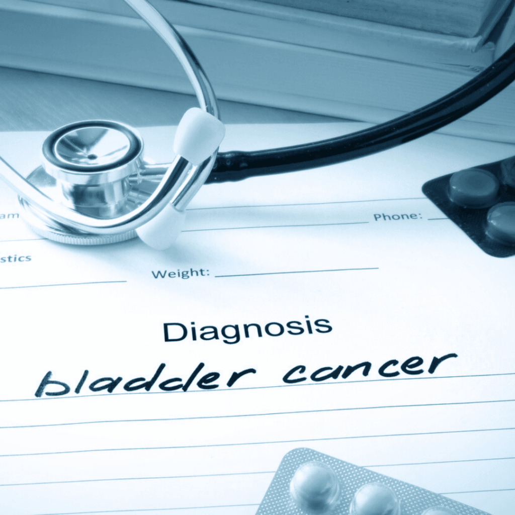Bladder Cancer Lawsuit: Gulf Coast